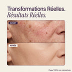 Couvrant Peau Parfaite ROSELOIRE™